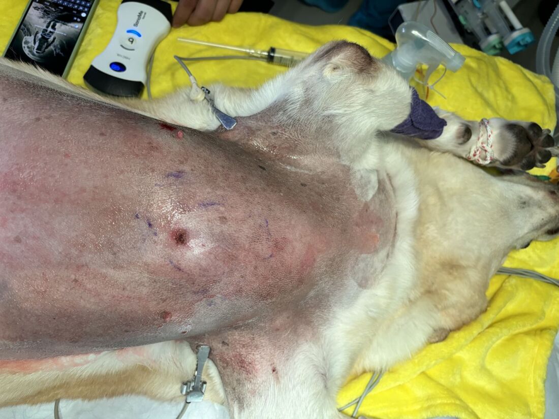 avance-sarcoma-1 Costa Rica