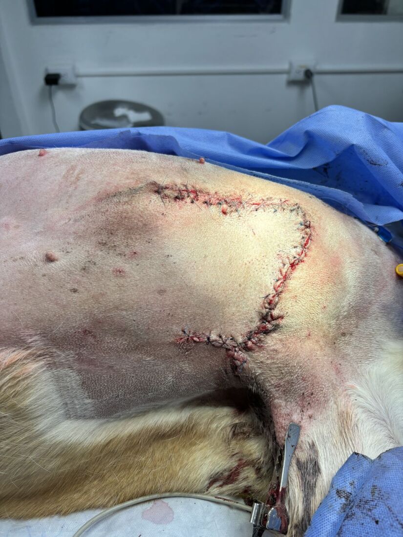 avance-sarcoma-4
